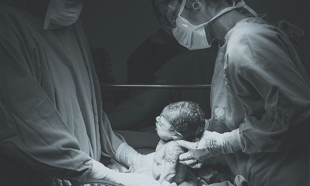 Vaginal birth or c-section?